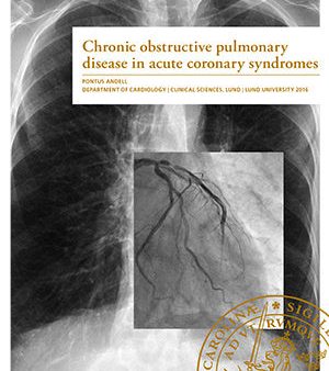 Chronic obstructive pulmonary disease in acute coronary syndroms For Cheap